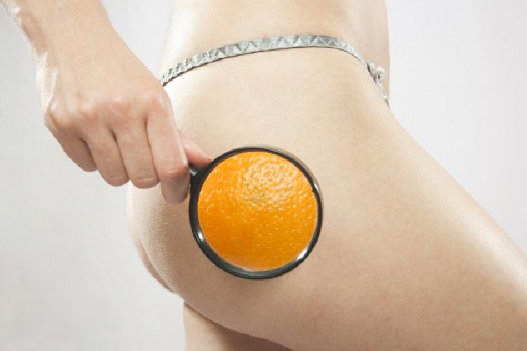 https://www.ragusanews.com/immagini_articoli/02-03-2018/cellulite-pelle-buccia-arancia-eliminarla-500.jpg