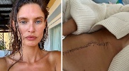 https://www.ragusanews.com/immagini_articoli/05-10-2024/bianca-balti-e-il-tumore-la-foto-della-cicatrice-e-l-inizio-della-chemio-100.jpg