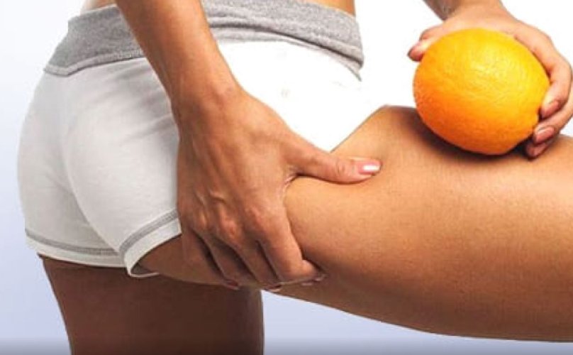 https://www.ragusanews.com/immagini_articoli/18-02-2021/eliminare-la-cellulite-e-possibile-con-una-dieta-sana-500.jpg